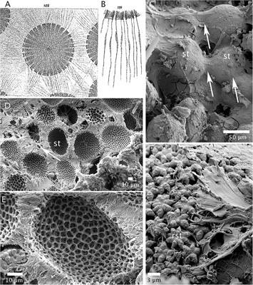 Surface Microornamentation of Demosponge Sterraster Spicules, Phylogenetic and Paleontological Implications